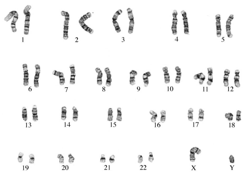 染色体核型分析
